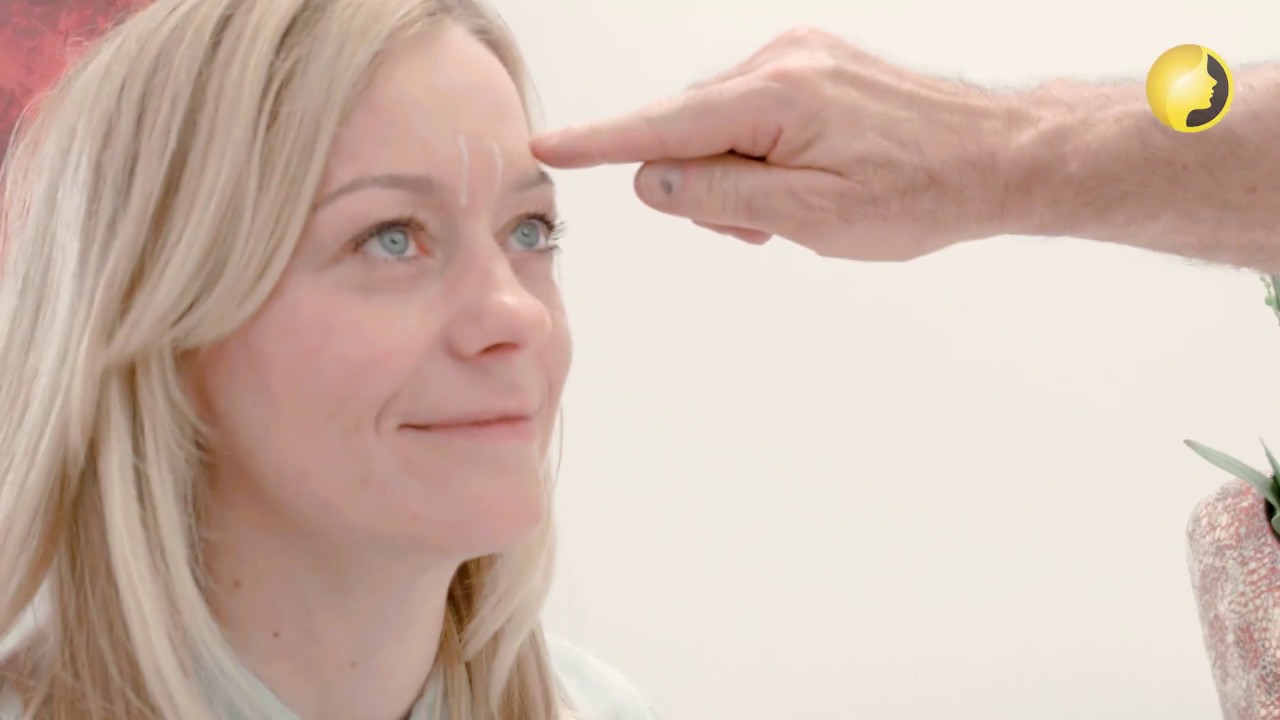 Botox Zornesfalten und Stirn
