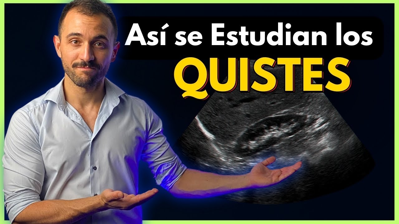 ¿Cómo se Ven y Diagnóstican los Quistes RENALES?