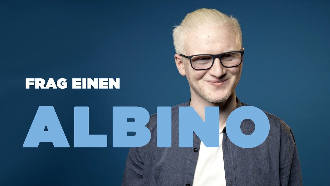 FRAG EINEN ALBINO | Furkan &uuml;ber das Leben als Exot
