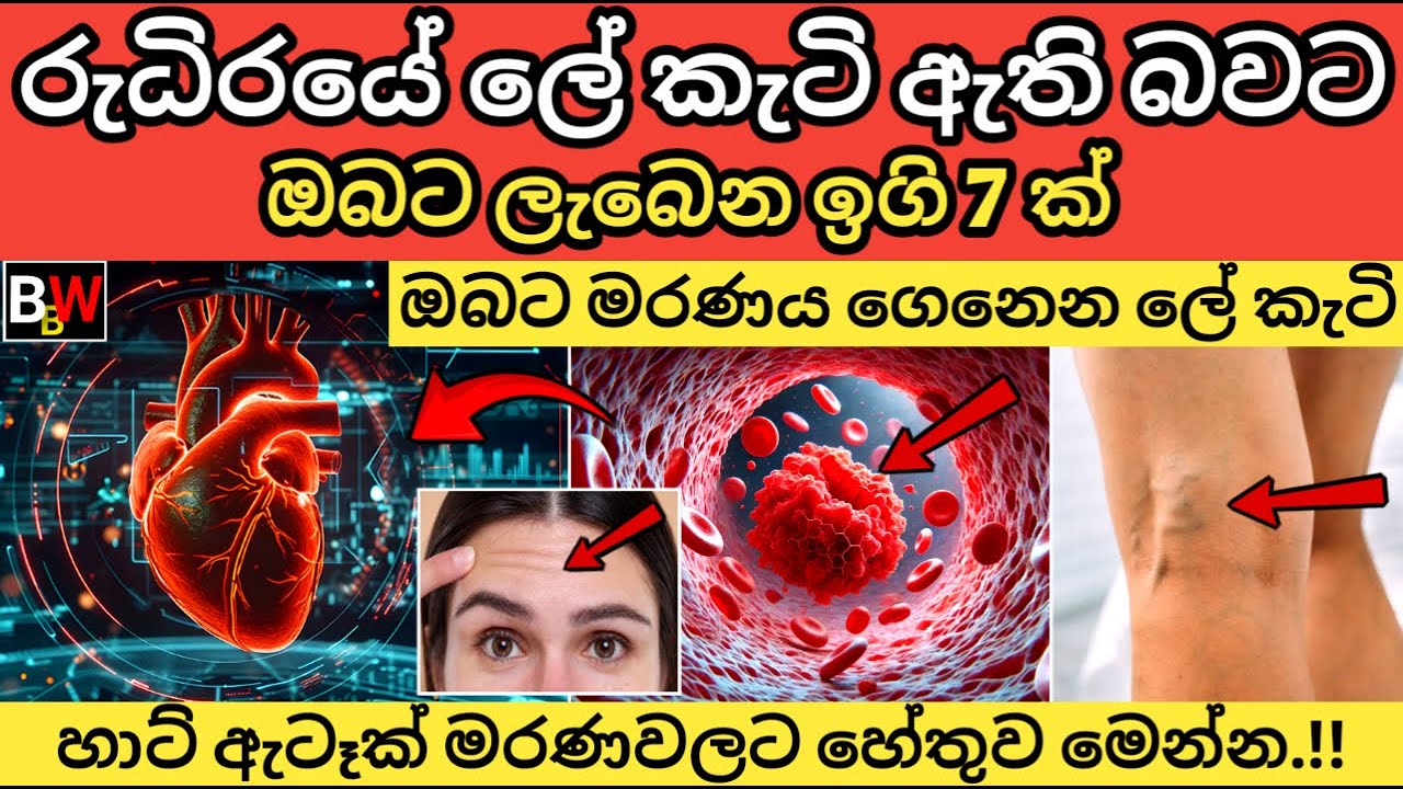 රුධිරයේ මාරාන්තික ලේ කැටි ඇති බවට ඔබට ලැබෙන ඉගි 7ක්. Blood Clots : Symptoms, Risk & Emergency Steps.