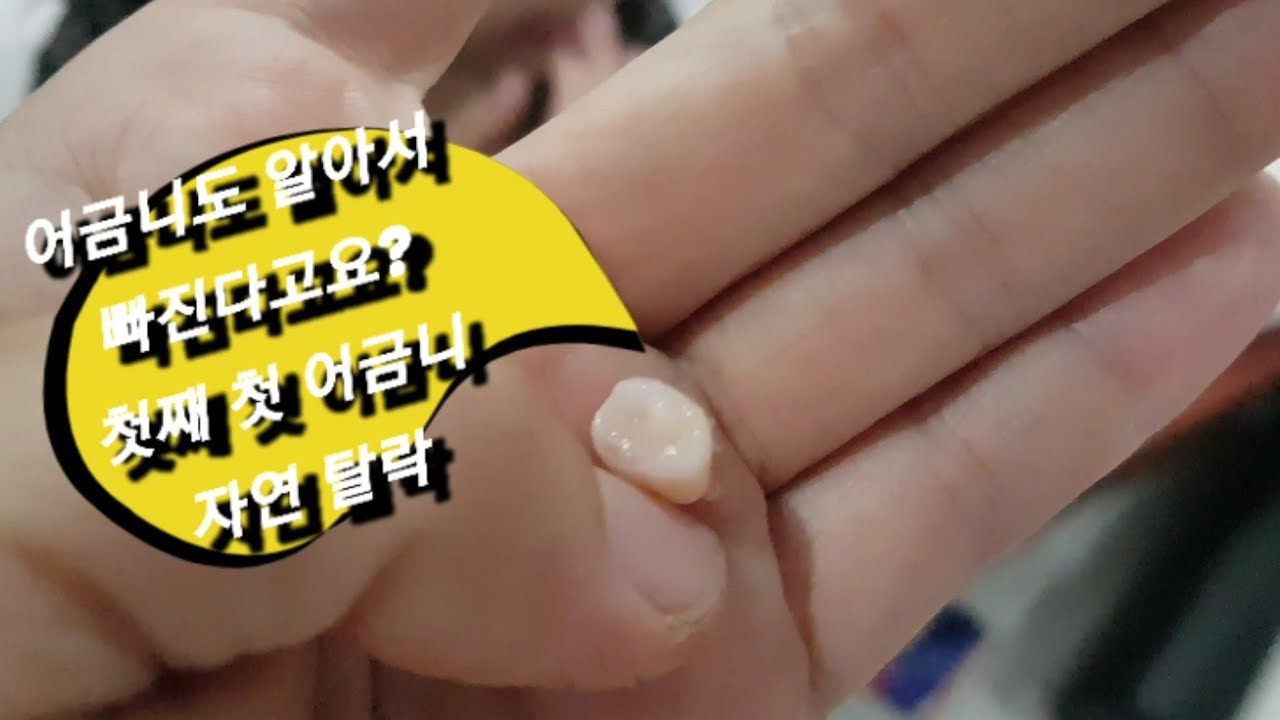 첫 어금니 빠진날 The Day My Daughter’s First Molar Fell Out