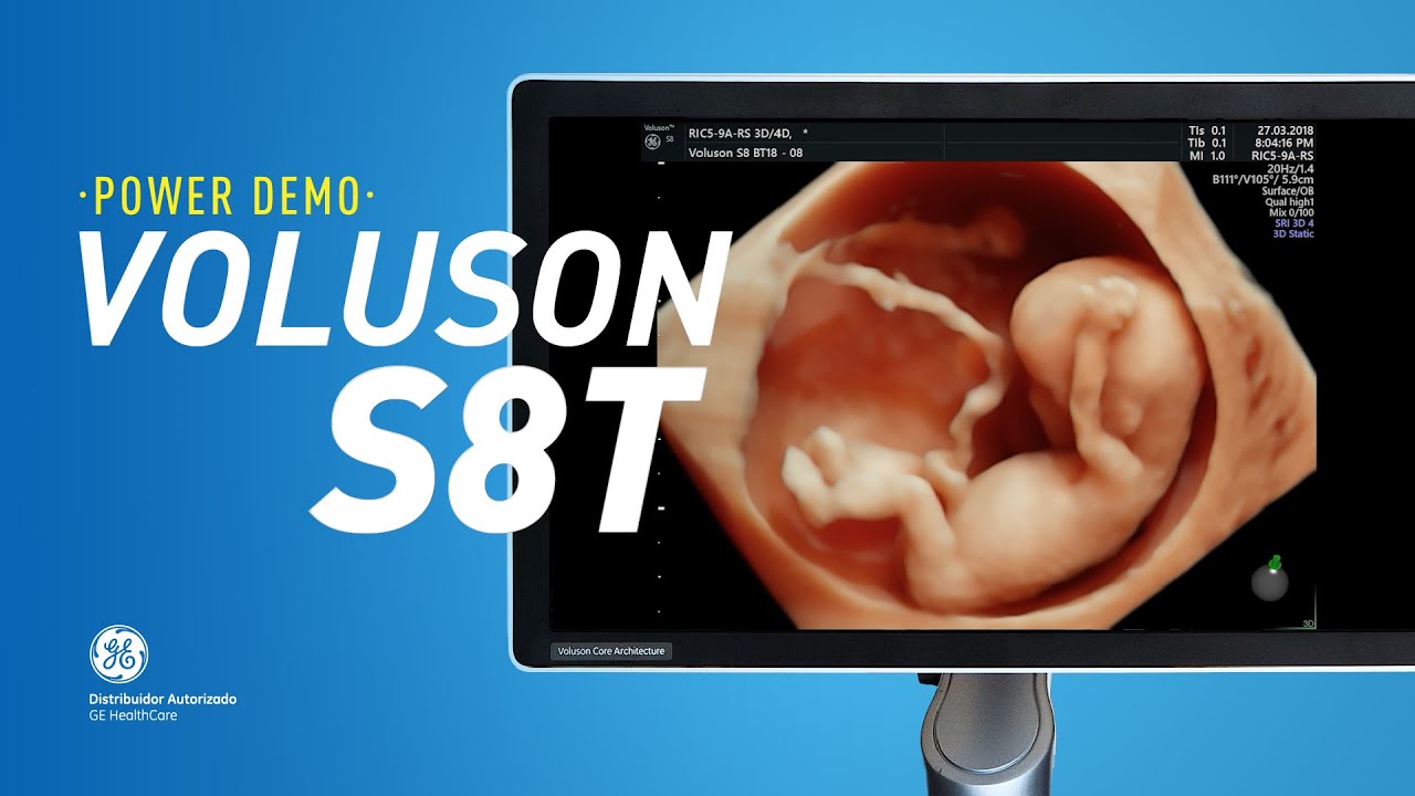POWER DEMO - GE VOLUSON S8T