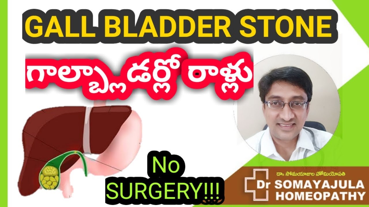 GALL BLADDER STONE / గాల్బ్లాడర్లో రాళ్లు / పిత్తాశయం/ Diet / Homeopathic medicines / No Surgery
