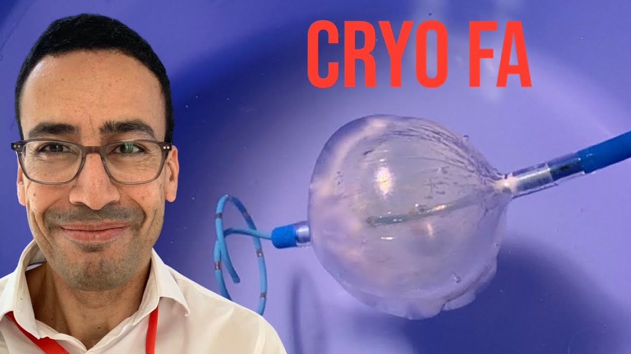 Ablation FA : Comment fonctionne un ballon de cryothérapie ?