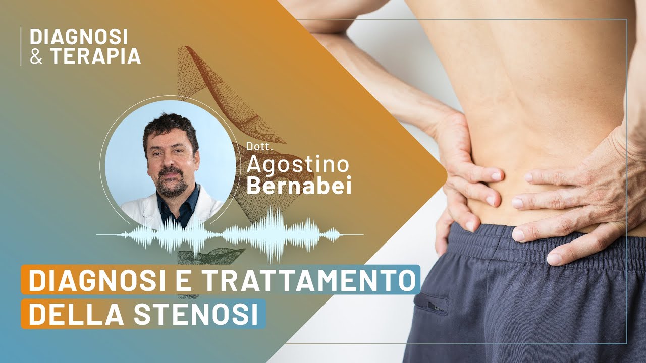 Stenosi vertebrale: diagnosi e trattamento - Dott. Agostino Bernabei