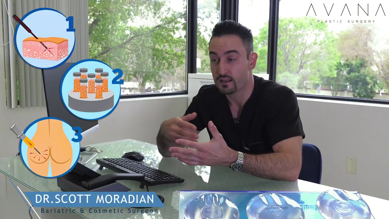 What is a Brazilian Butt Lift? -  Dr. Scott Moradian talks about BBL | Avana Plastic Surgery