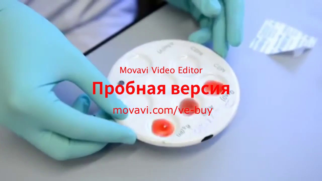 Reactii serologice - Rus