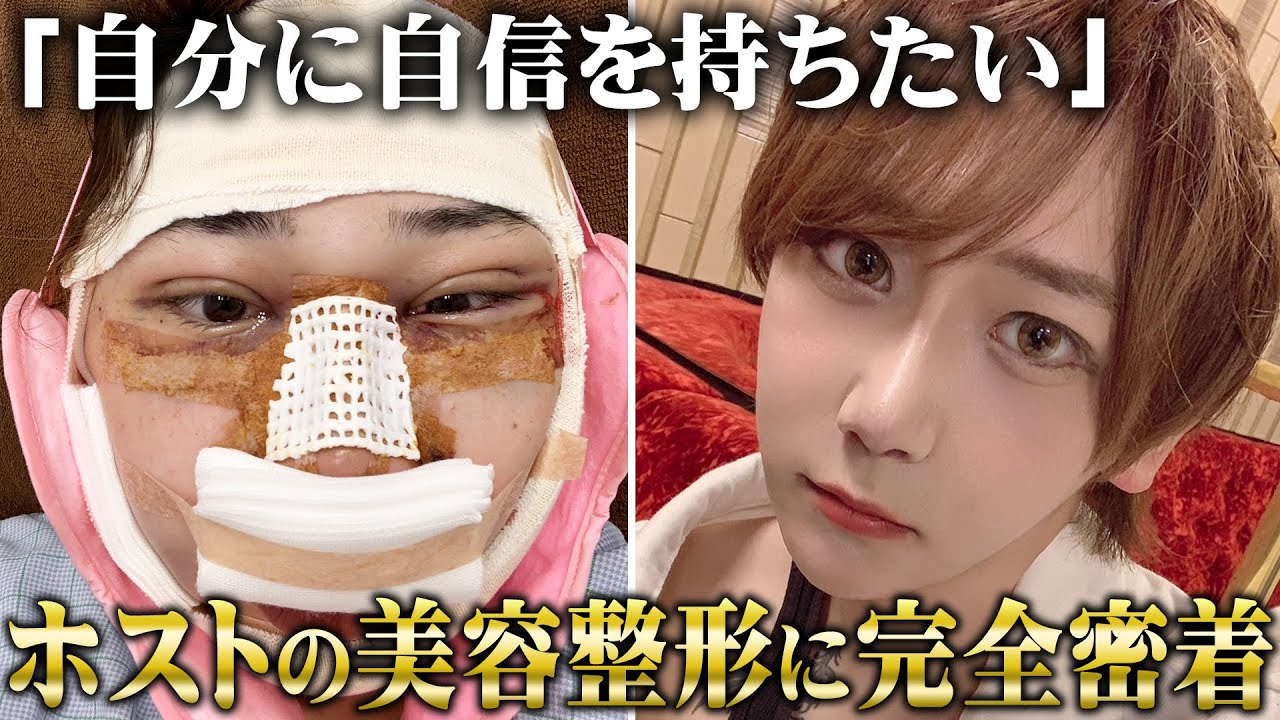 「ホストとして自信を持ちたい...」コンプレックスを払拭するため整形を決意したホストに完全密着【CLUB CERN】【バウム美容外科】
