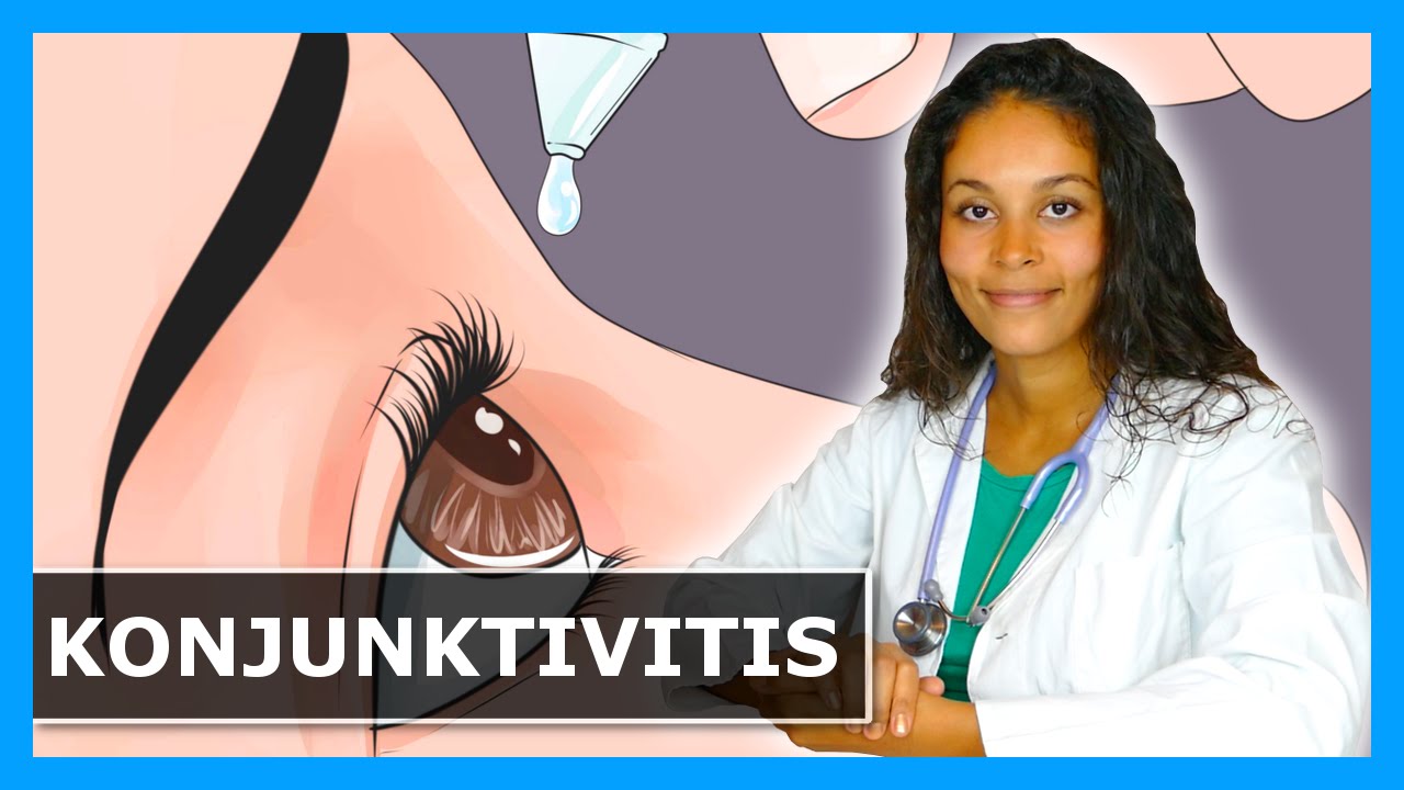 BINDEHAUTENTZÜNDUNG: Behandlung & Tipps gegen GERÖTETE, JUCKENDE und VERKLEBTE AUGEN