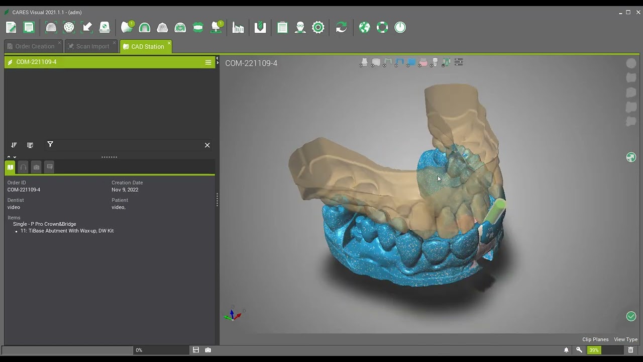 Create a TiBase Abutment with Wax up to copy a crown