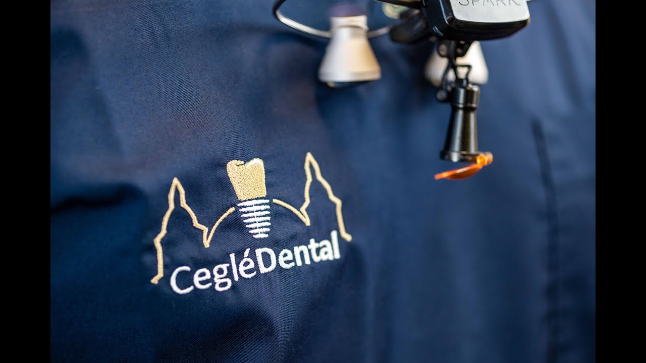 Fogászati implantátum beültetéssel kapcsolatos néhány gyakori kérdés