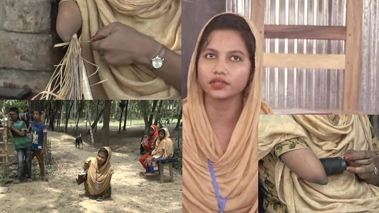 দুই পা ও একটি হাত ছাড়াই এগিয়ে যাচ্ছে যশোরের শাহিদা