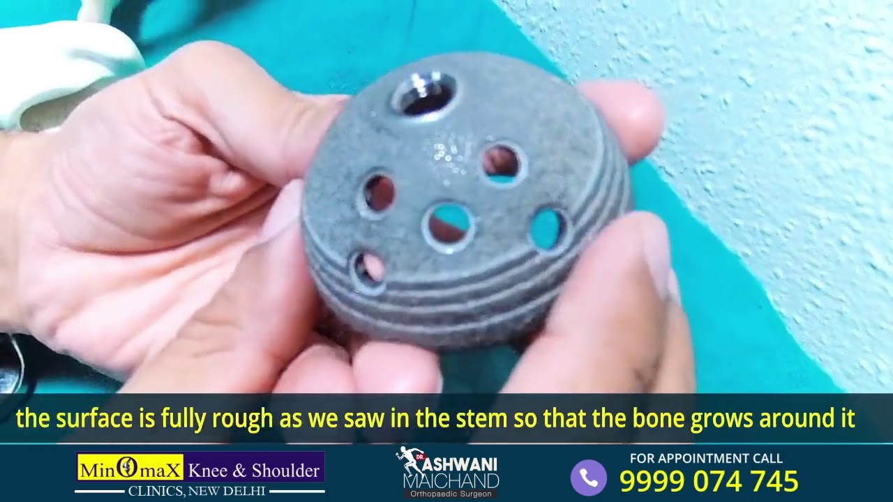 Types of hip replacement implants by Dr Ashwani maichand