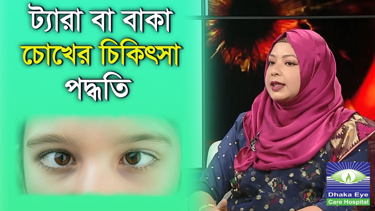 ট্যারা চোখ বা বাকা চোখের চিকিৎসা পদ্ধতি কি কি জেনে নিন | Dhaka Eye Care Hospital