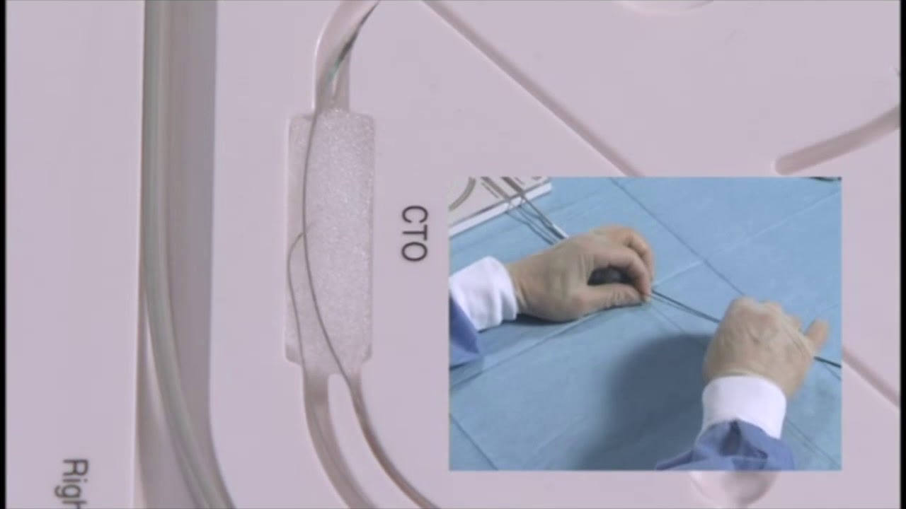 Angioplasty technique: a retrograde approach for CTO (+English subtitle)
