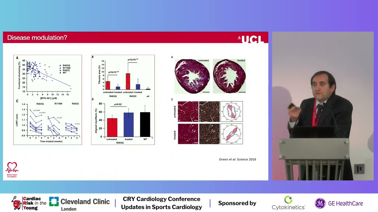 Managing hypertrophic cardiomyopathy in the young - Professor Juan Kaski