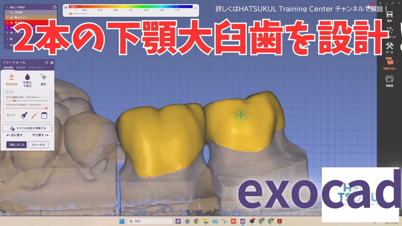 #282　exocad設計　2本の下顎大臼歯を設計（解説なし版）