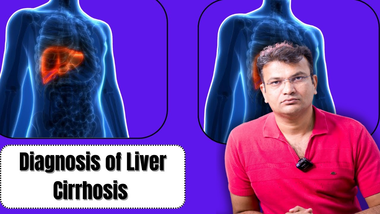 Liver Cirrhosis का पता लगाने के लिए की जाने वाली सभी जांचे कोन-सी होती है ? Diagnosis of Cirrhosis