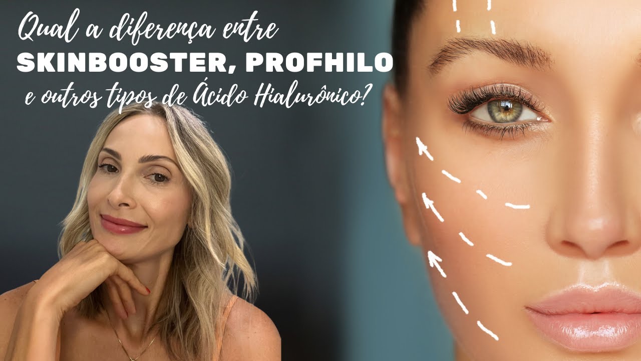 Qual a diferença entre skinbooster, profhilo e outros ácidos hialurônico?