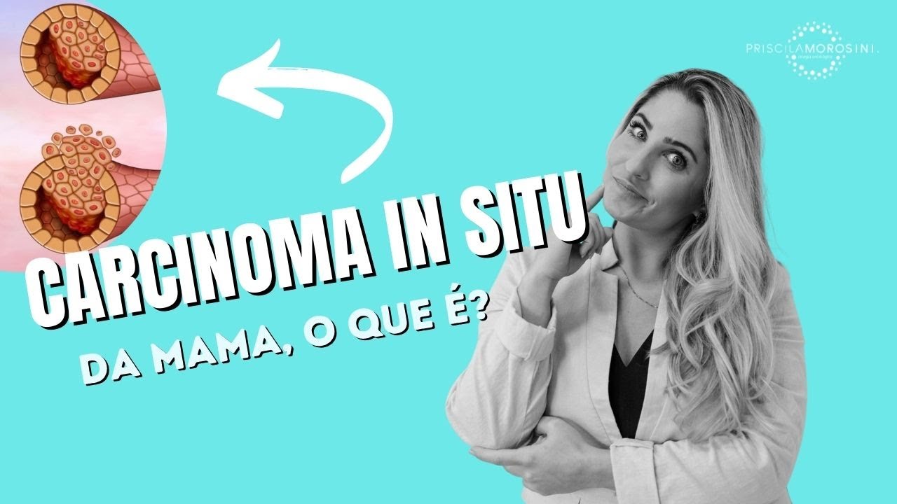 Carcinoma in situ da mama: O que é?