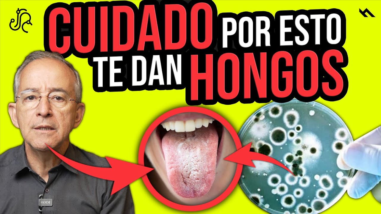 CUIDADO POR ESTO TE DAN HONGOS O CANDIDIASIS - Oswaldo Restrepo RSC