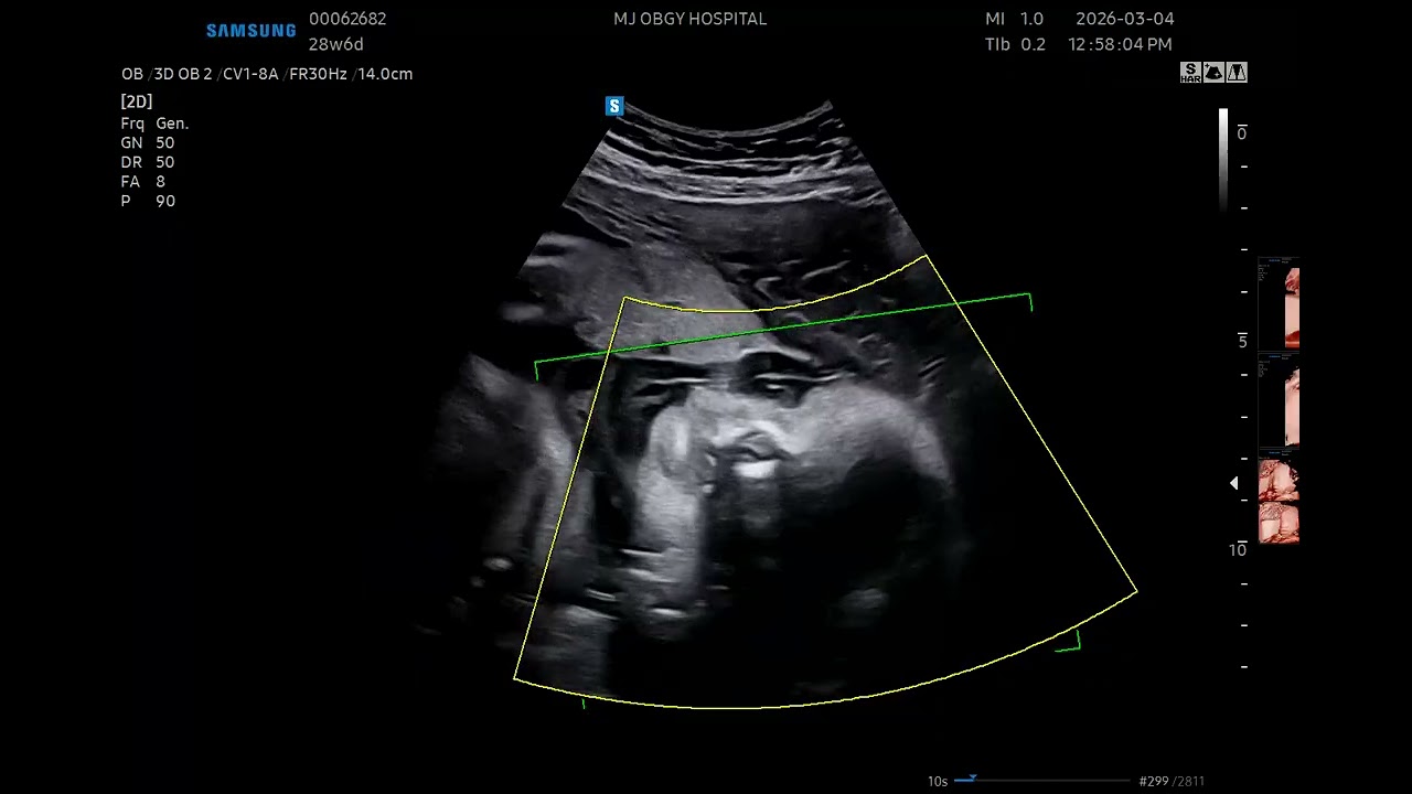 2026.03.04 땡글이 초음파 22