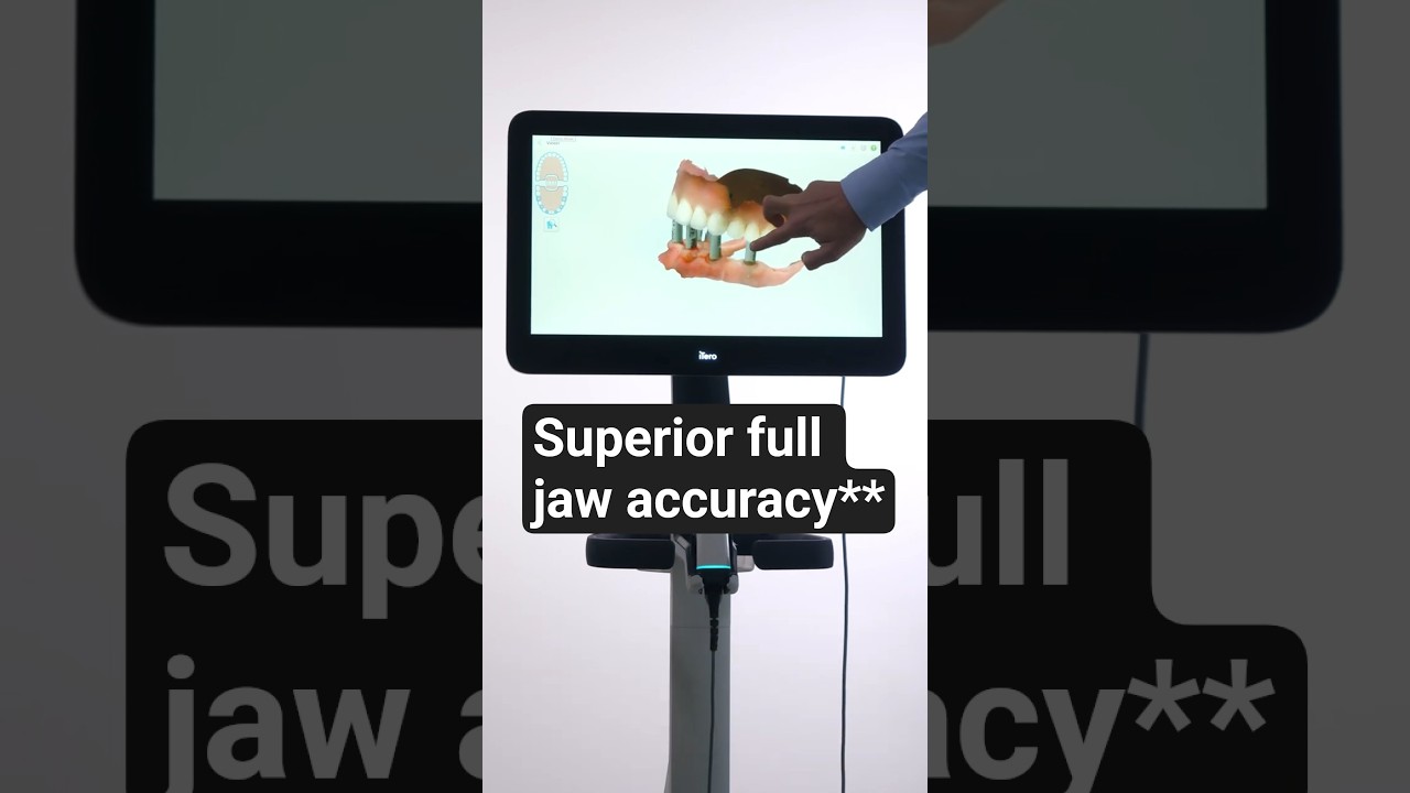 Accuracy that matters: iTero Lumina&trade; intraoral scanner for full-arch restorations