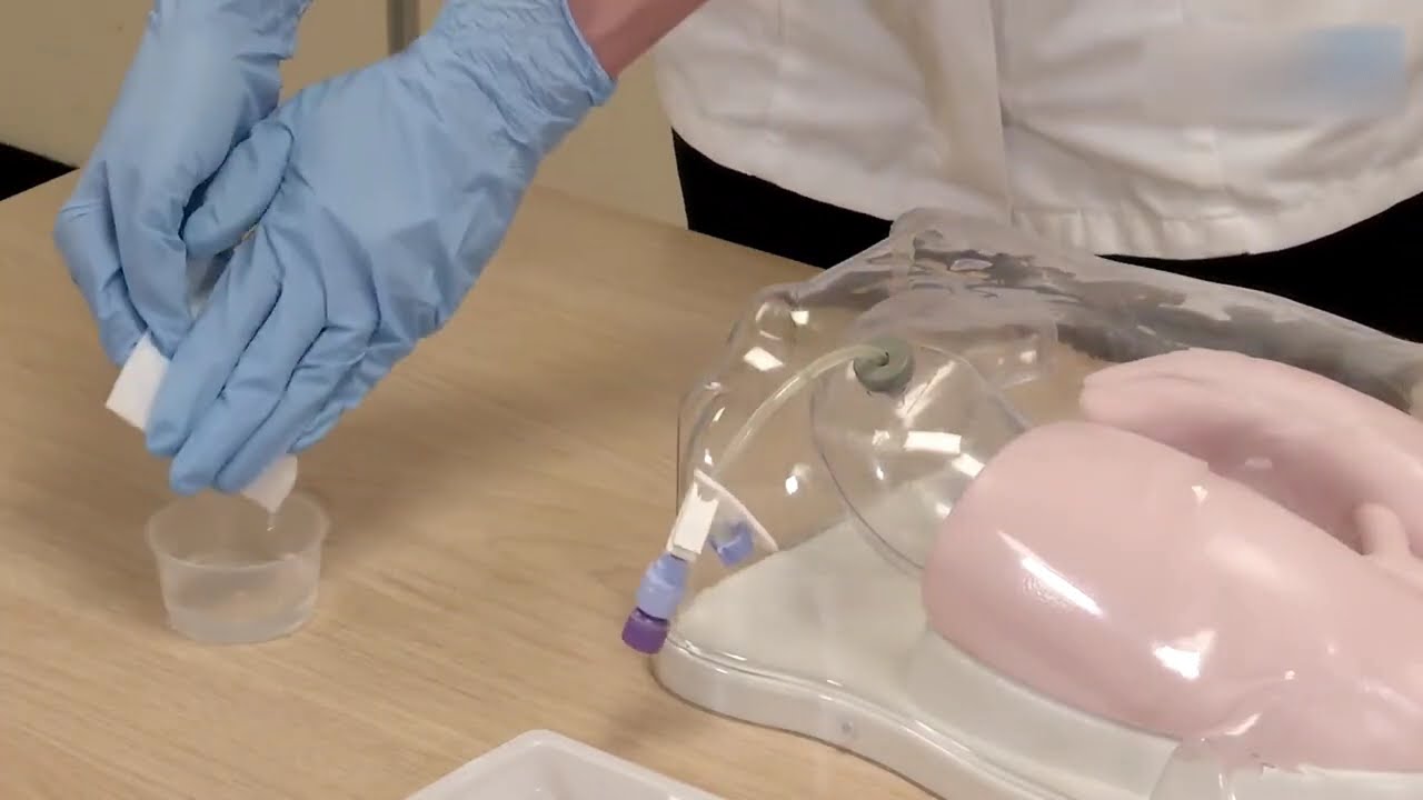 Jak przesuwać i obracać Freka PEG (przezsk&oacute;rna endoskopowa gastrostomia)