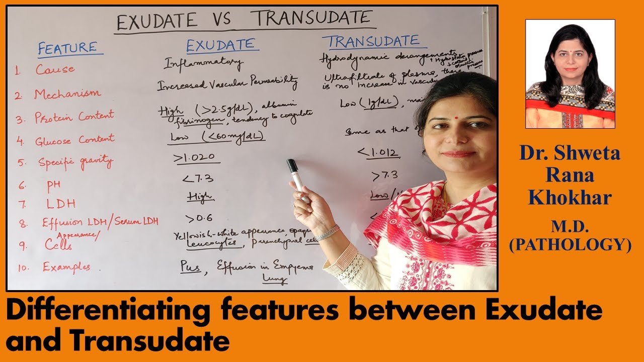 Exudate vs Transudate: Differentiating features between Exudate and Transudate
