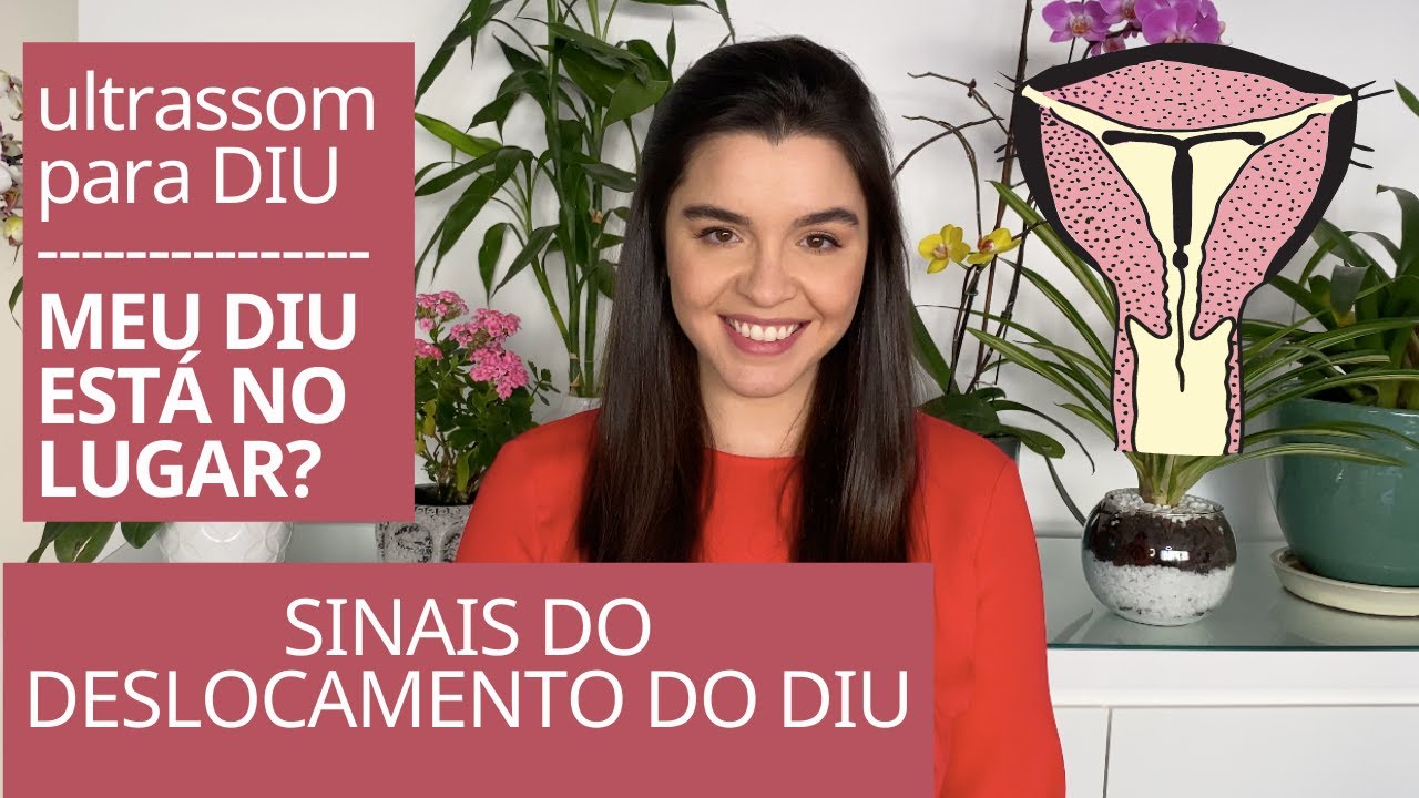 Como eu sei se meu DIU está no lugar? Deslocamento do DIU, precisa de ultrassom? Meu DIU está baixo
