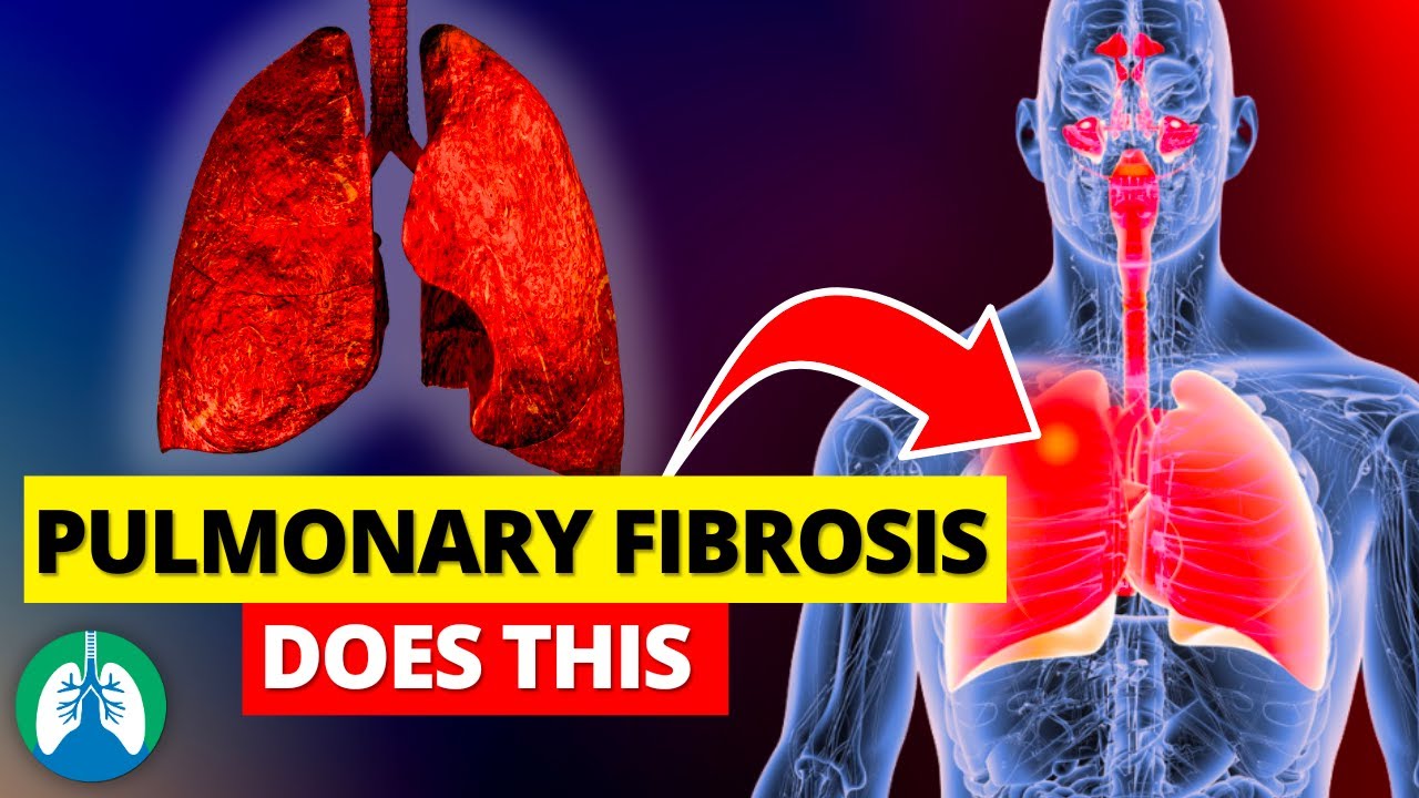 Pulmonary Fibrosis Does THIS to Your Lungs