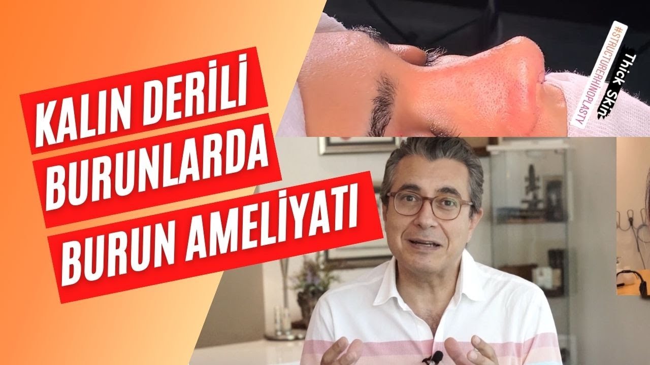 Kalın Derili Burunlarda Burun Ameliyatı