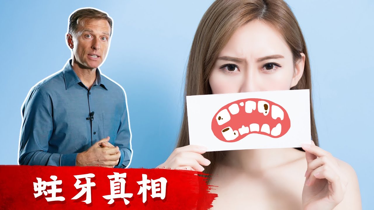 蛀牙真相,全球第二大常見疾病, 預防蛀牙, 柏格醫生Dr berg