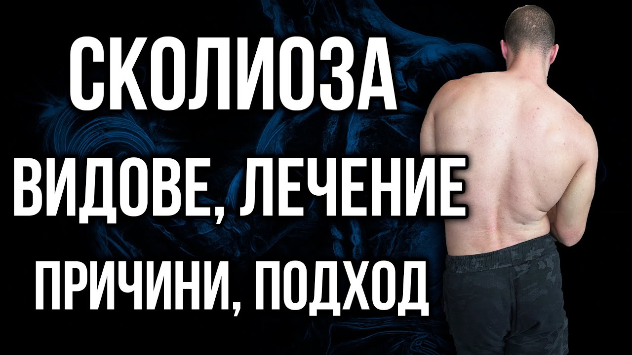 Какво е СКОЛИОЗА - Видове, Причини, Упражнения, Тестове