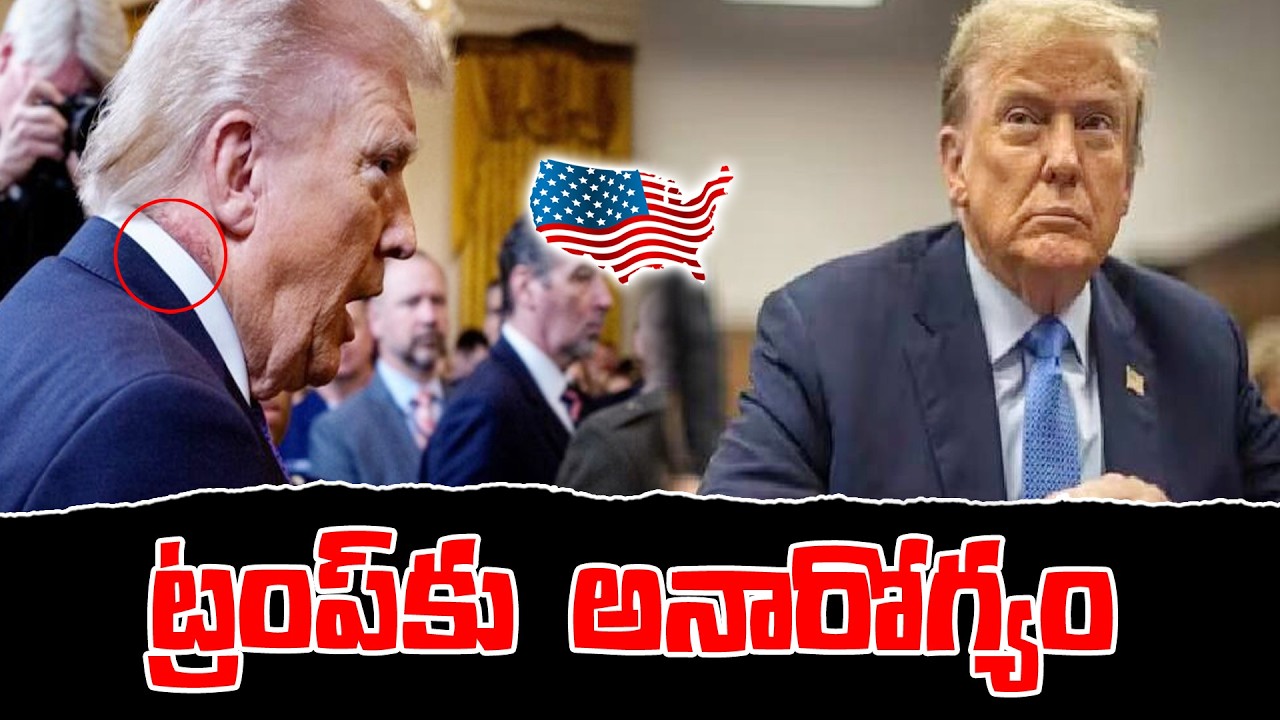 Health issue for Trump | What is the health issue he got ? | KKNewsTelugu