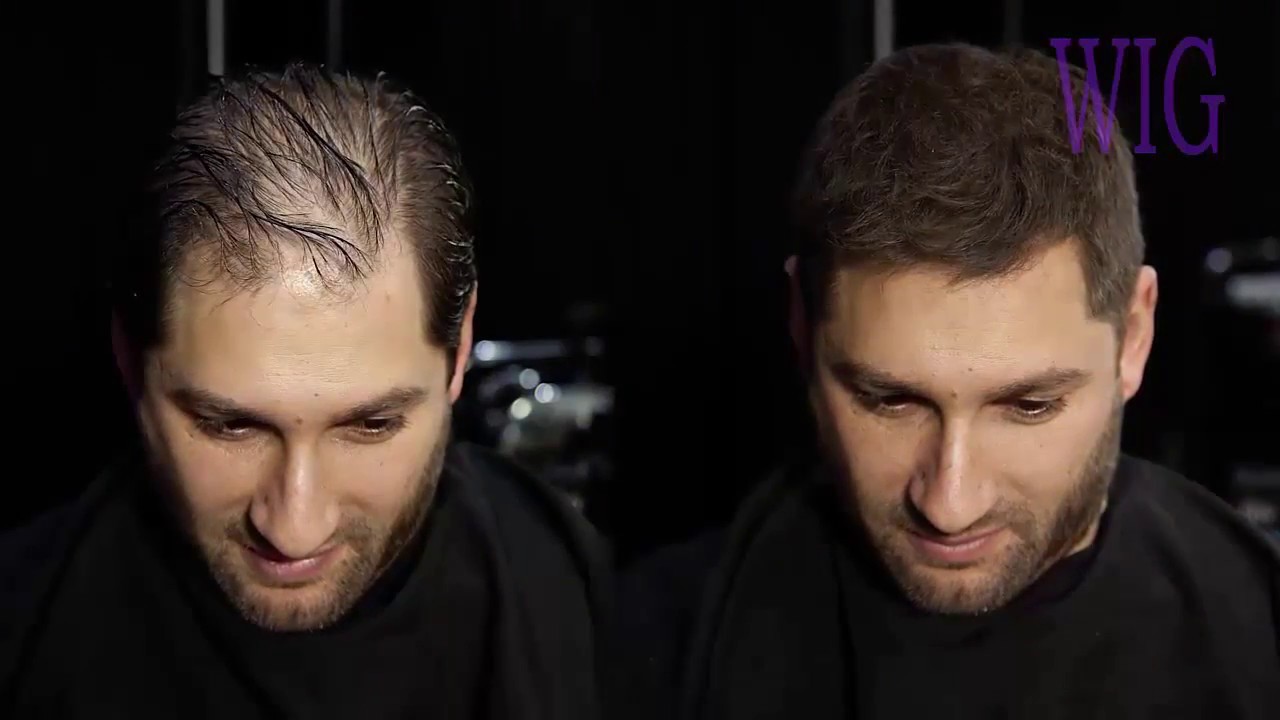 How To Cut And Disguise Thinning Hair | Men's Hair