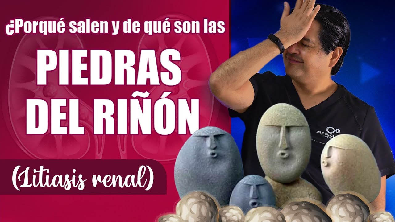¿Porqué salen y de qué son las piedras del riñón?🤕💢🪨 PARTE UNO -Litiasis Renal-