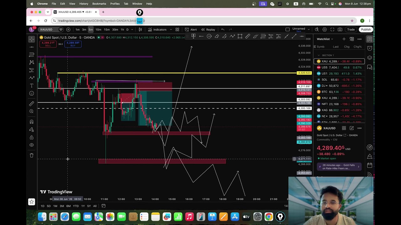 live gold trading