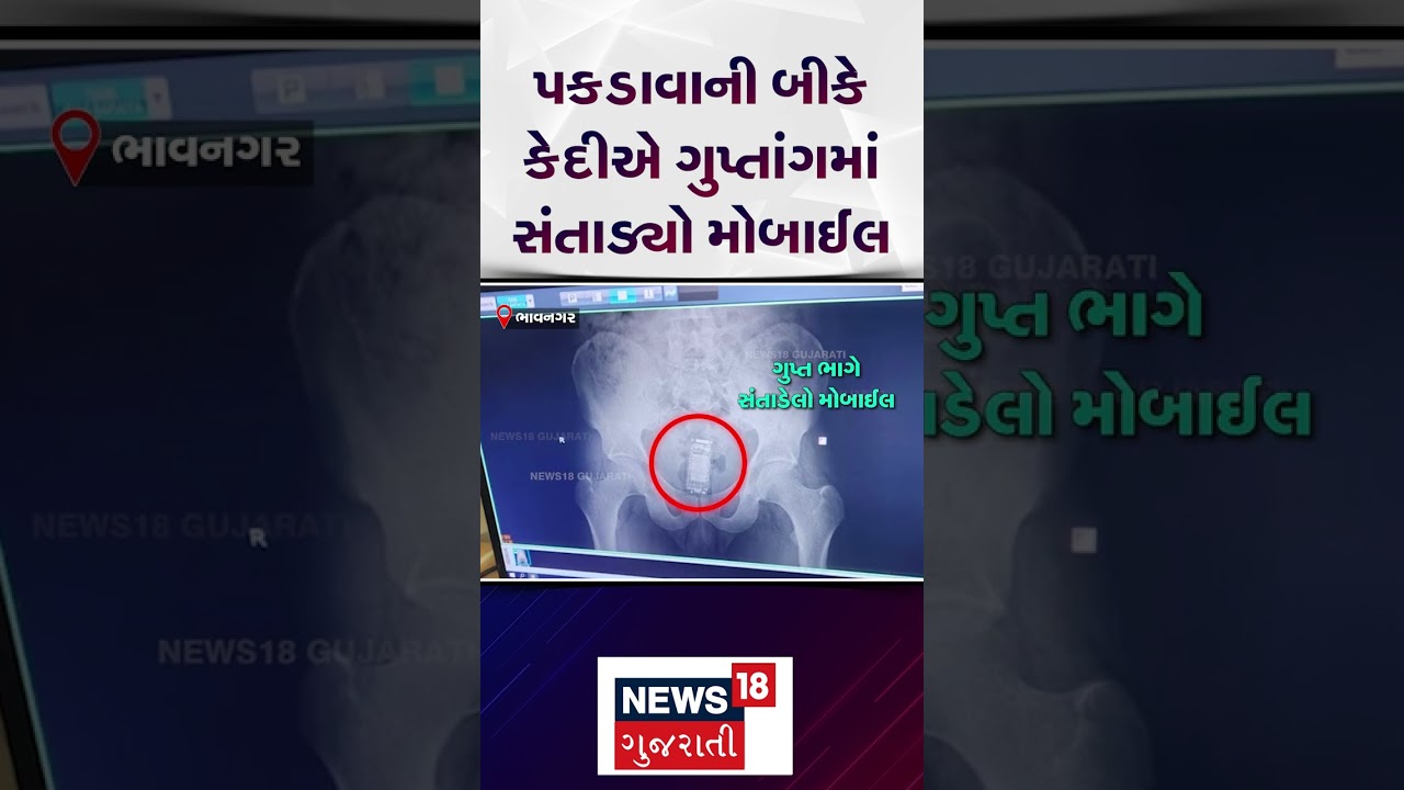 Bhavnagar News | Fearing arrest, prisoner hides mobile in private parts | Jail | Gujarati News | N18S