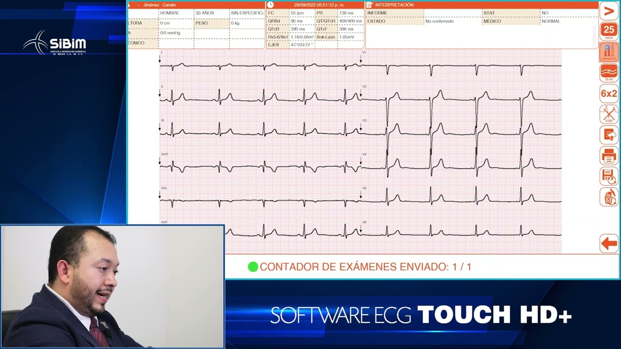 Capacitación ECG Touch HD + CARDIOLINE