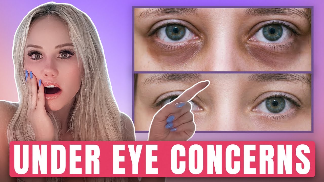 Looking Tired? Ask a Doctor! FREE Consultation - Live Q&A