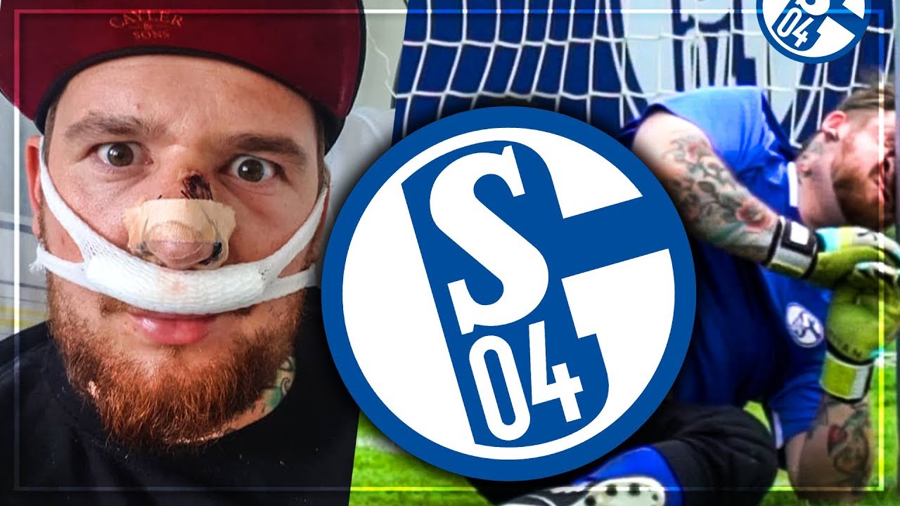 Fussball CHALLENGE gegen SCHALKE PROFI endet in KRANKENHAUS OP 😱
