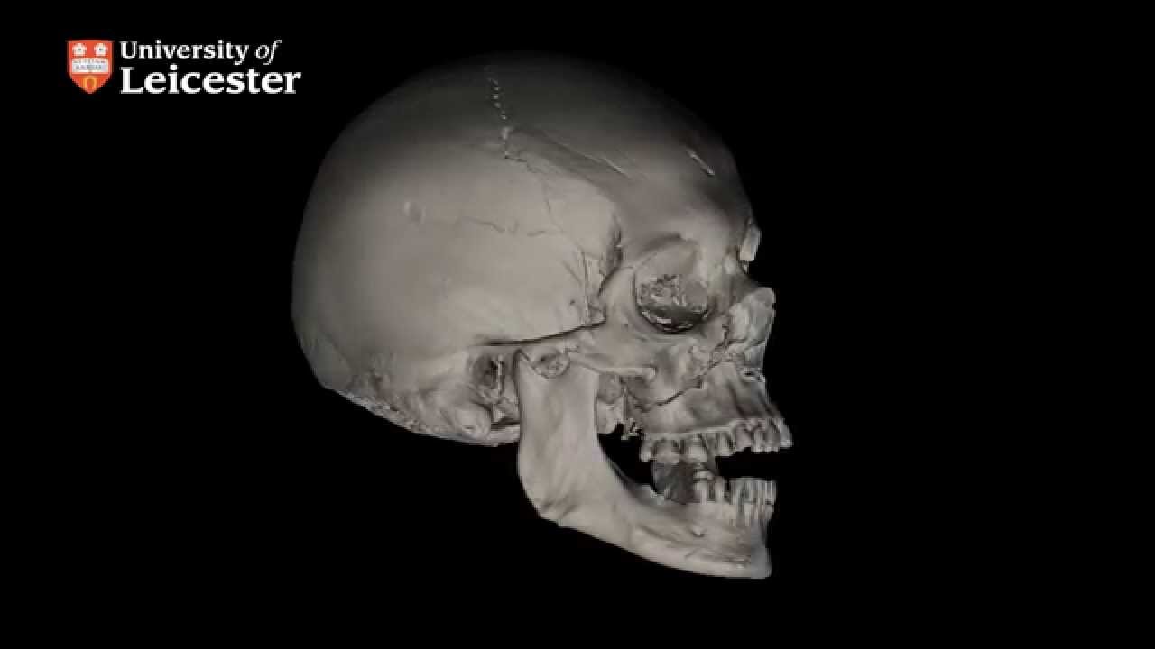 micro-CT Scan of Richard III's Skull