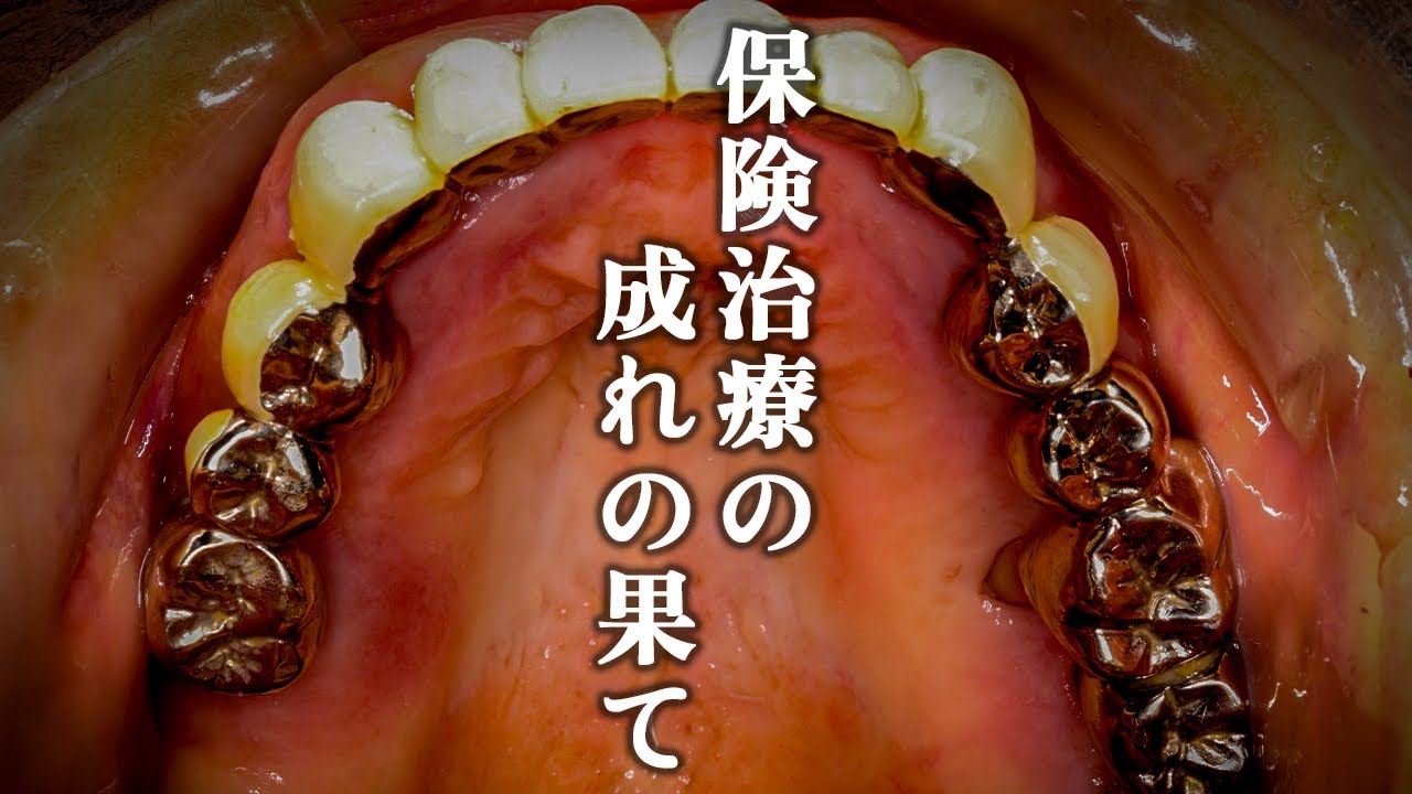 完璧な保険治療の成れの果て...