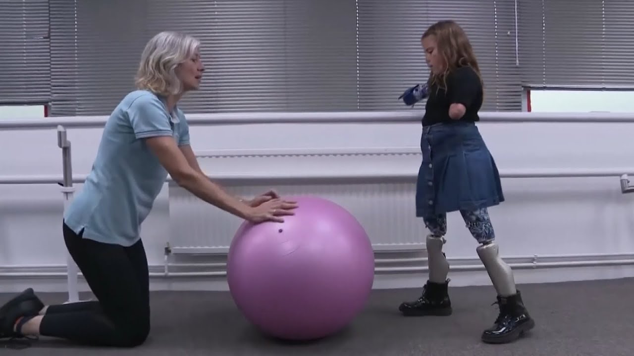 8-Year-Old Girl Gets Computerized Prosthetics