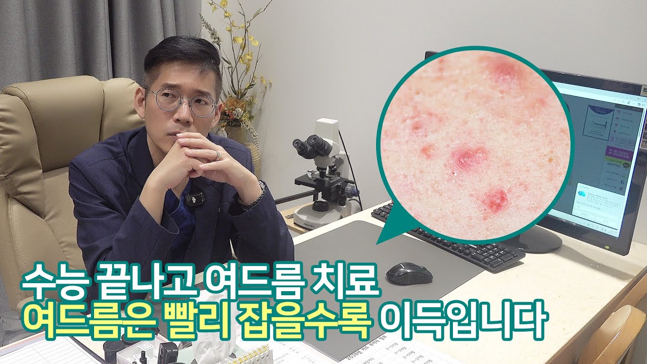 수능 끝나고 여드름 치료여드름은 빨리 잡을수록 이득입니다.