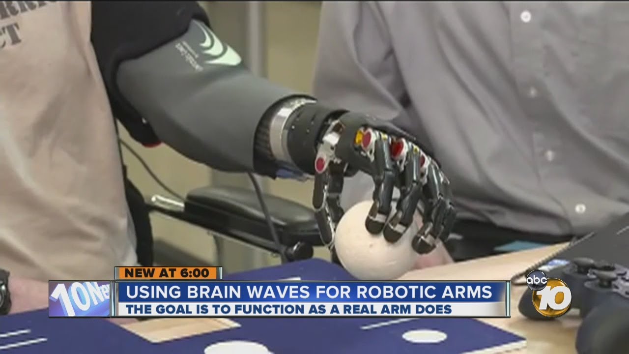 Researchers hoping new robotic technology, brain implant will help amputees