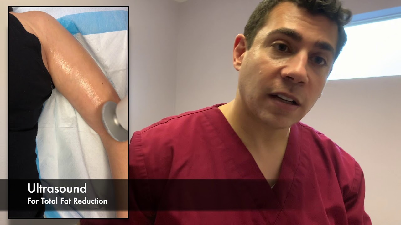 Body Contouring Accent Prime Dr Jonathan Yousef DO