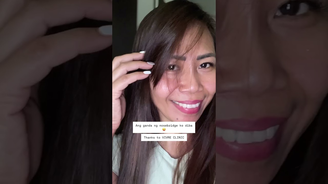 HIKO THREAD LIFT / NOSE BRIDGE #noselift  #goodvibes #selfcare #hiko #threadlift  #trend