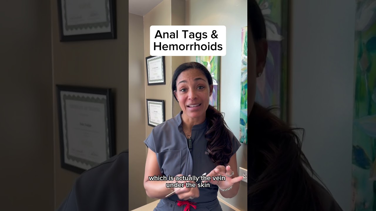 Anal tags & hemorrhoids&mdash;no shame! Prevent with fiber, manage with @bydrpoucher (50% off!). #women